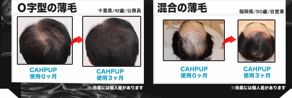 �`���b�v�A�b�v(CHAPUP)�̌���