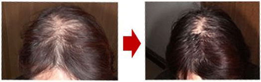 �`���b�v�A�b�v(CHAPUP)�̏����̔��ь���