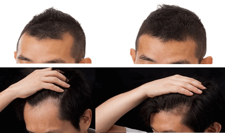 ��p�v�����e���̌���